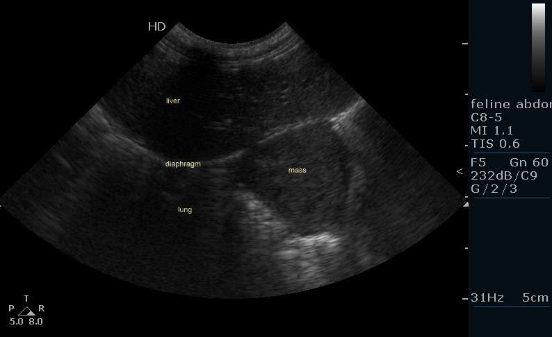transdiaphragmatic view