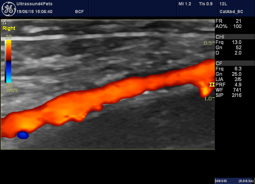 abdominal aorta colour Doppler