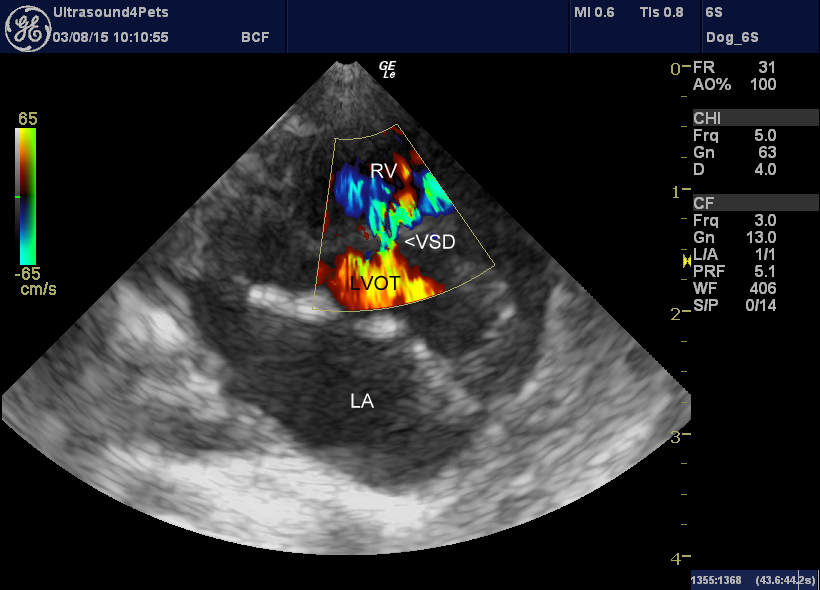 Right-sided transverse plane view of the heart at a level just below the aortic valve.
