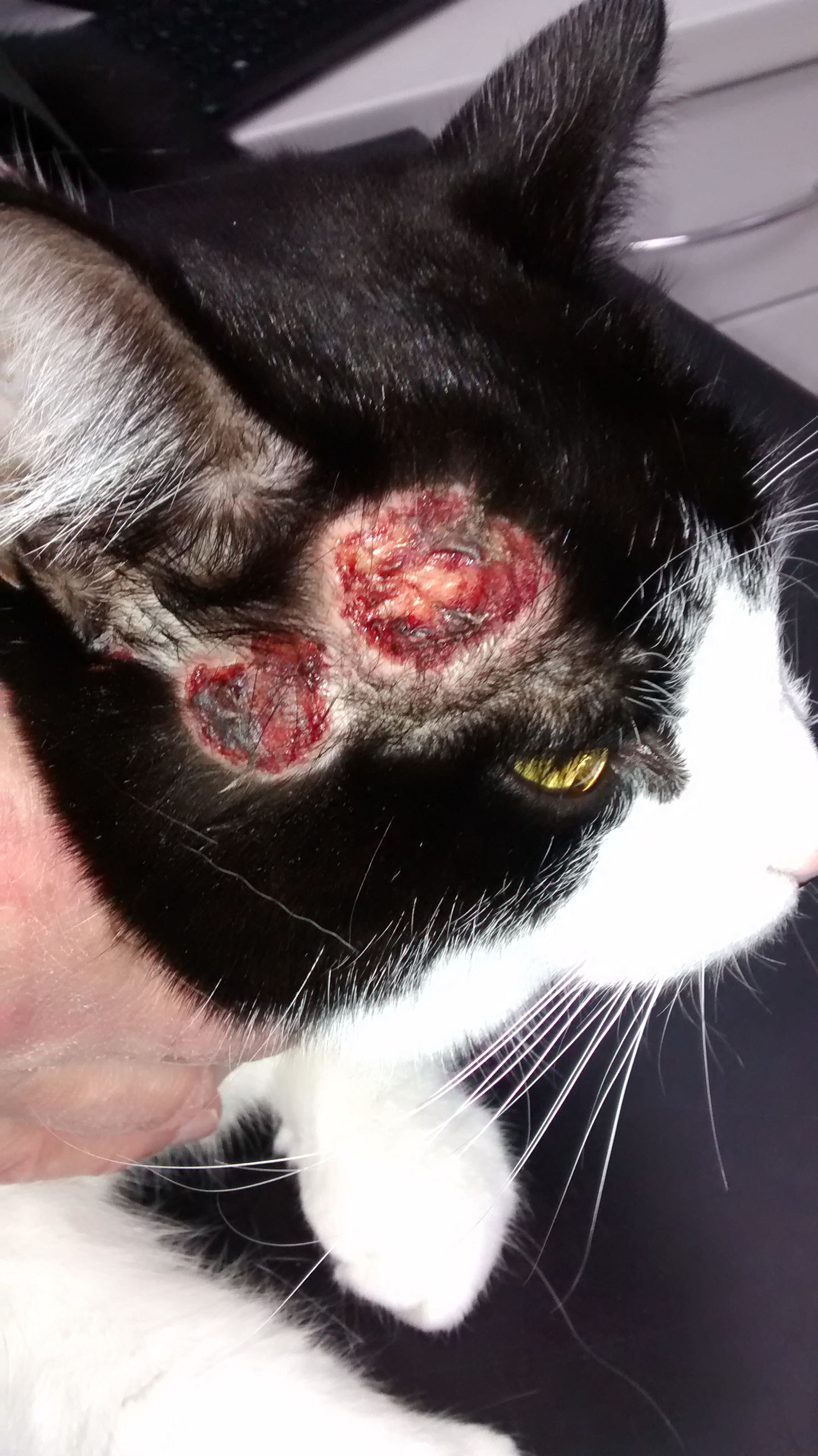 cutaneous adverse reaction to spironolactone: these lesions are intensely pruritic
