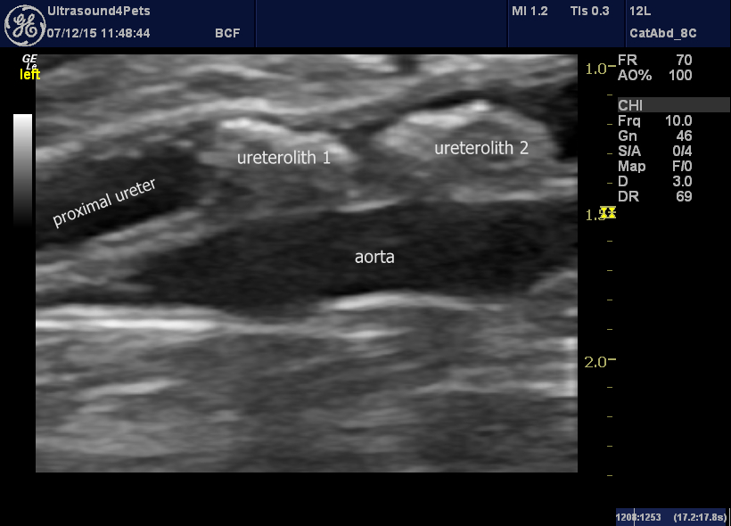 R ureter (as seen from the left!)
