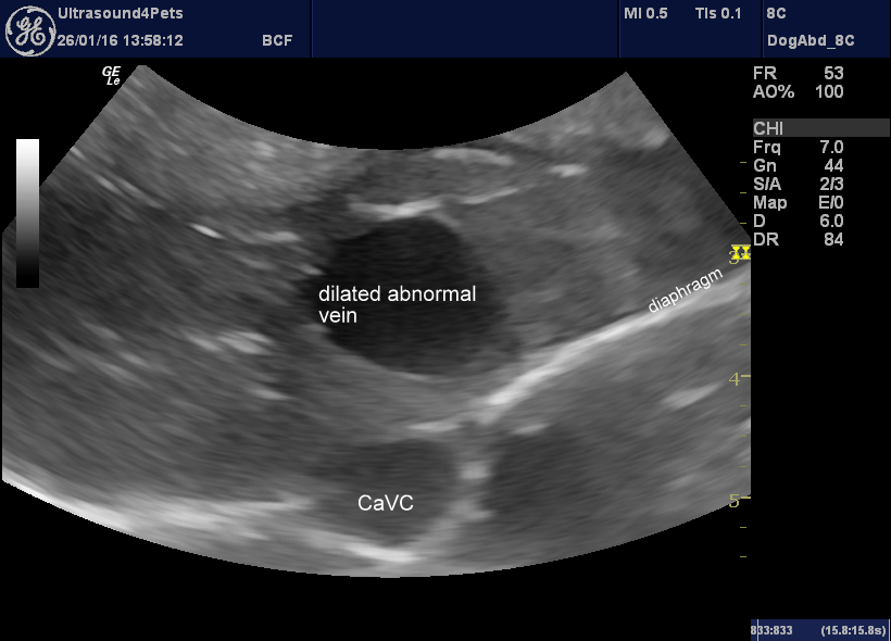 liver transverse view of central section