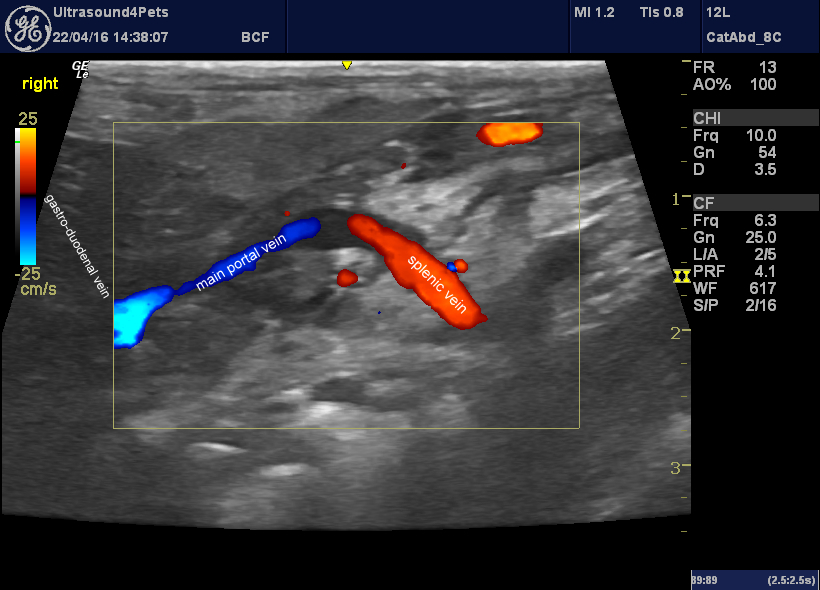 main portal vein from R side